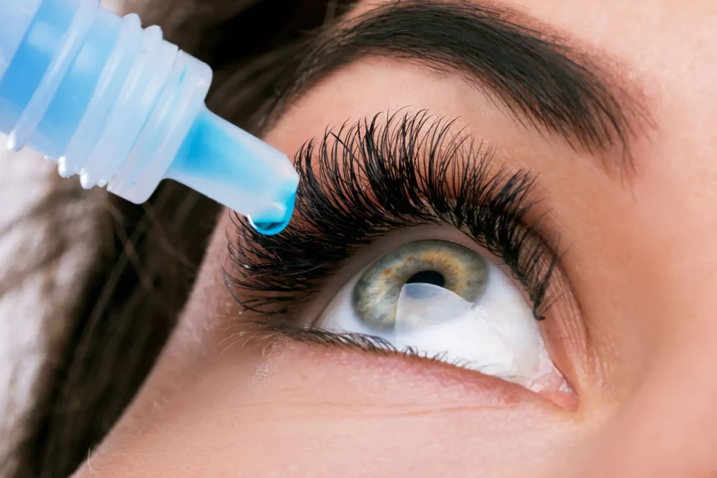 Alocril eye drop bottle being squeezed to administer medication into a patient's eye.